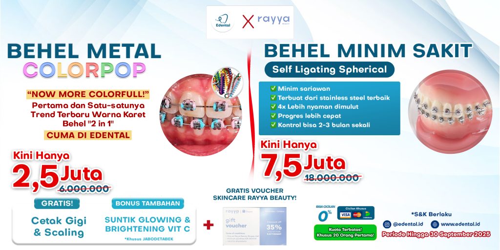 SPECIAL OFFER EDENTAL !