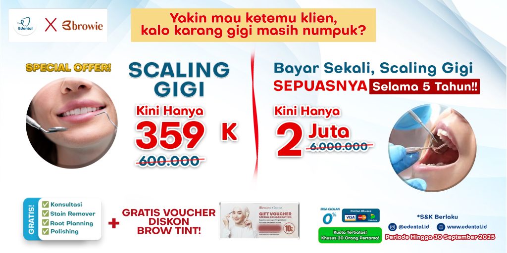 PROMO SCALING