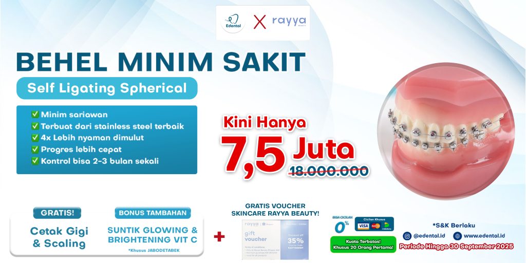 PROMO BEHEL SELF LIGATING